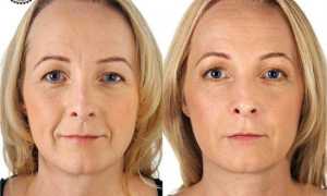 Крем от морщин – отзывы