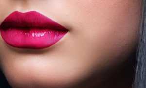 Уход за губами после увеличения гиалуроновой кислотой – чем мазать и как ухаживать?