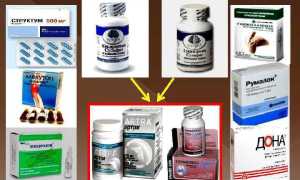 Хондропротекторы для суставов – лучшие препараты