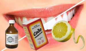 Отбеливание зубов в домашних условиях