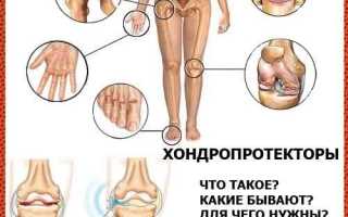 Хондропротекторы – что это и как работает?
