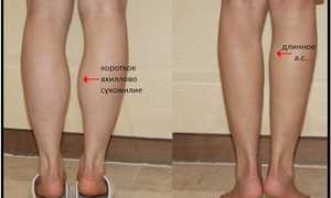 Как похудеть в икрах ног: упражнения и растяжка мышц