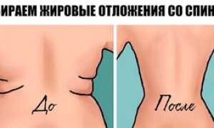 Как убрать жир со спины у женщины