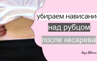 Как убрать живот после кесарева сечения?
