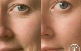 Крем от морщин вокруг глаз – отзывы