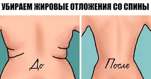 Как бороться с жиром на спине