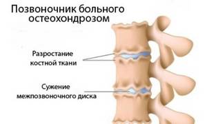 Комплекс упражнений 