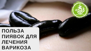 Преимущества метода