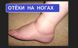 Выведение жидкости