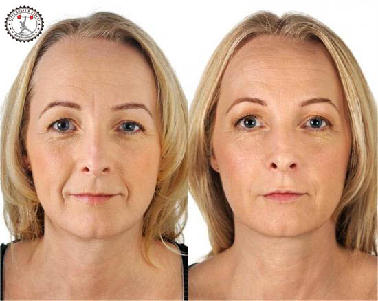 отзывы на крем от морщин после 50 лет