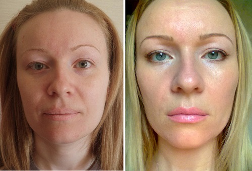 Отзывы пациентов