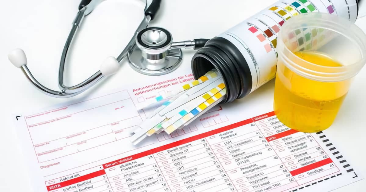 Кетоны в моче