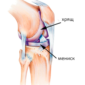 Коленный хрящ