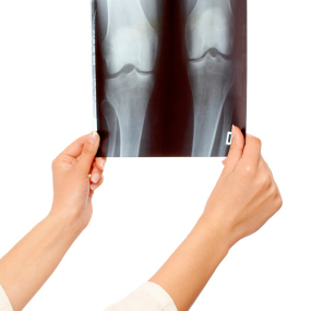 Рентген колена